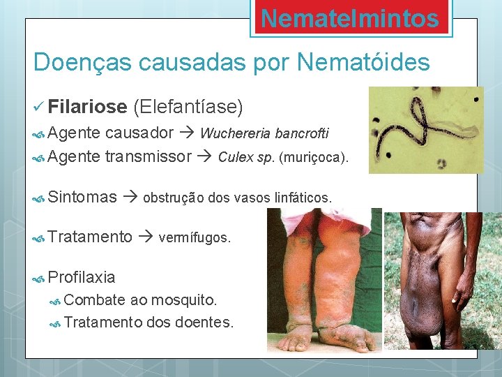 Nematelmintos Doenças causadas por Nematóides ü Filariose (Elefantíase) Agente causador Wuchereria bancrofti Agente transmissor