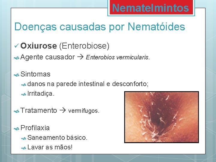 Nematelmintos Doenças causadas por Nematóides ü Oxiurose Agente (Enterobiose) causador Enterobios vermicularis. Sintomas danos