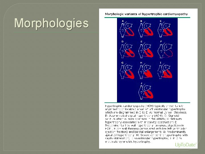 Morphologies 