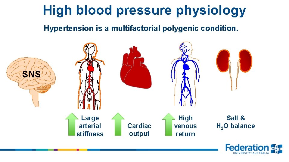 High blood pressure physiology Hypertension is a multifactorial polygenic condition. SNS Large arterial stiffness
