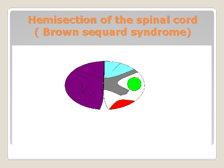 Hemisection of the spinal cord ( Brown sequard syndrome) 