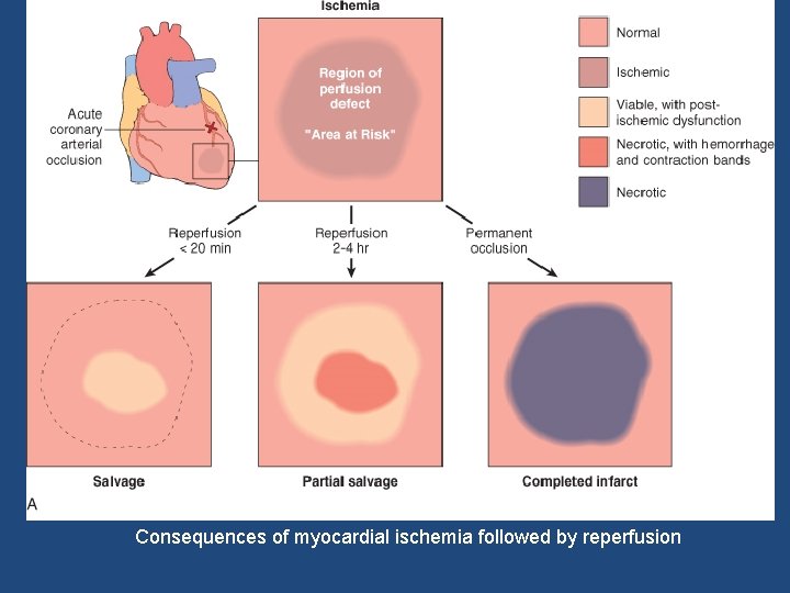 Consequences of myocardial ischemia followed by reperfusion 