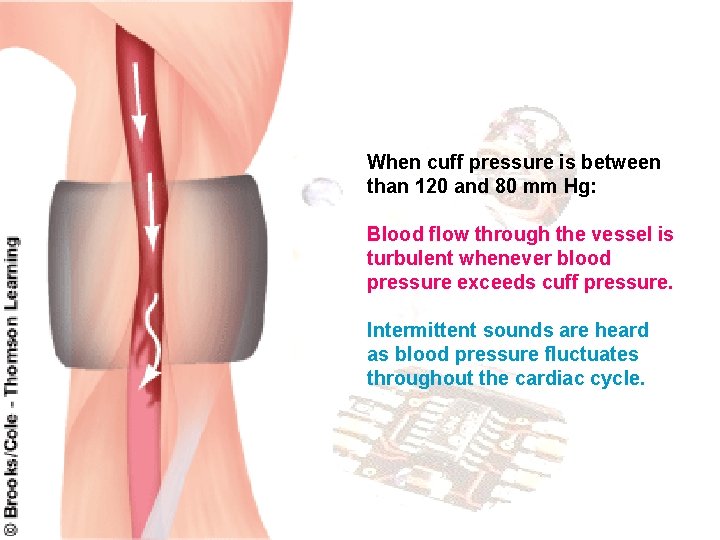 When cuff pressure is between than 120 and 80 mm Hg: Blood flow through
