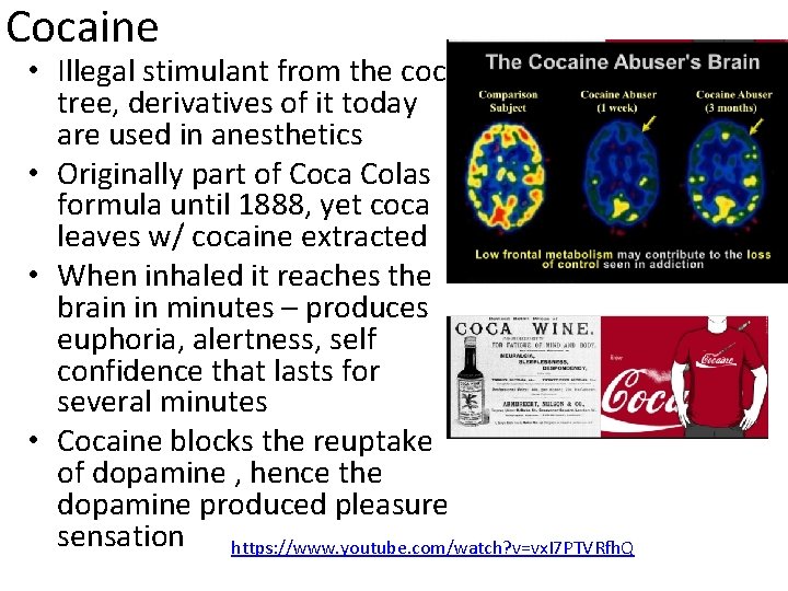 Cocaine • Illegal stimulant from the coca tree, derivatives of it today are used