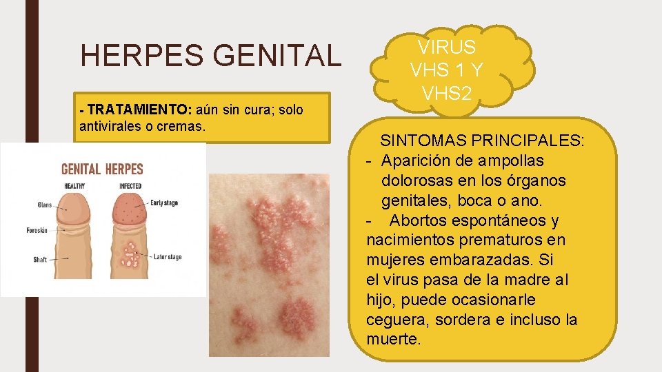 HERPES GENITAL - TRATAMIENTO: aún sin cura; solo antivirales o cremas. VIRUS VHS 1
