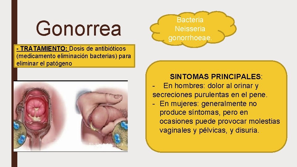 Gonorrea Bacteria Neisseria gonorrhoeae. - TRATAMIENTO: Dosis de antibióticos (medicamento eliminación bacterias) para eliminar