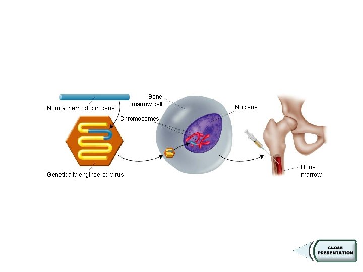 Figure 14 -21 Gene Therapy Section 14 -3 Bone marrow cell Normal hemoglobin gene