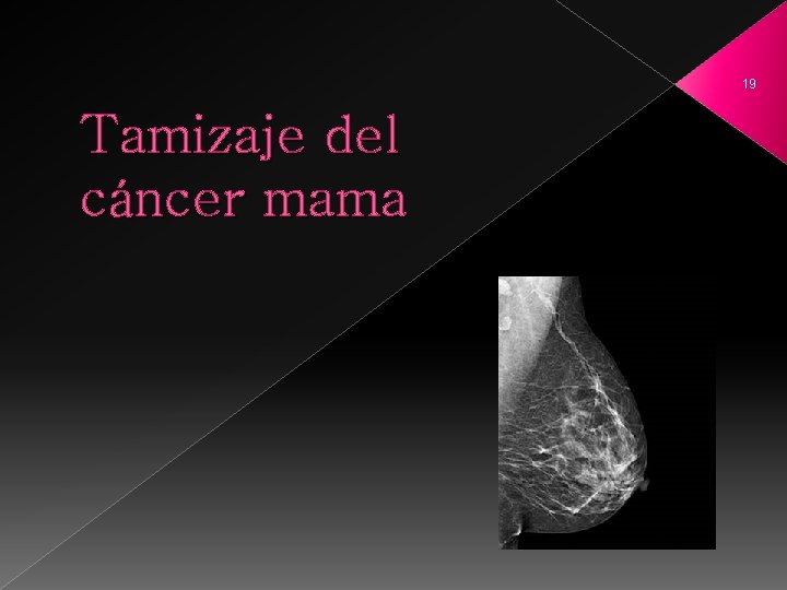 19 Tamizaje del cáncer mama 