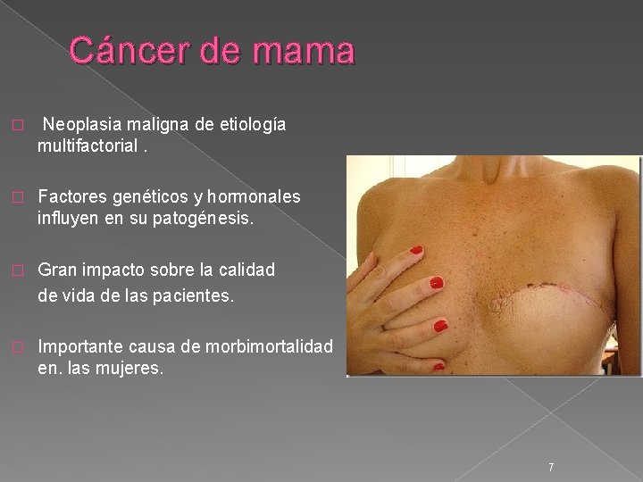 Cáncer de mama � Neoplasia maligna de etiología multifactorial. � Factores genéticos y hormonales