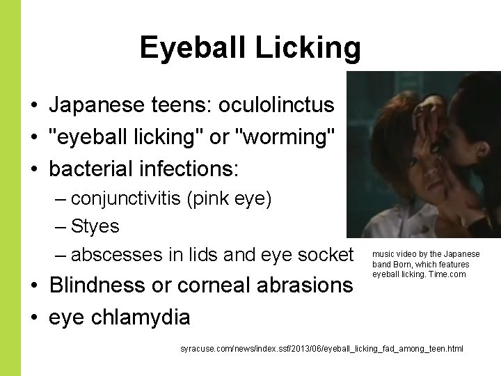 Eyeball Licking • Japanese teens: oculolinctus • "eyeball licking" or "worming" • bacterial infections: