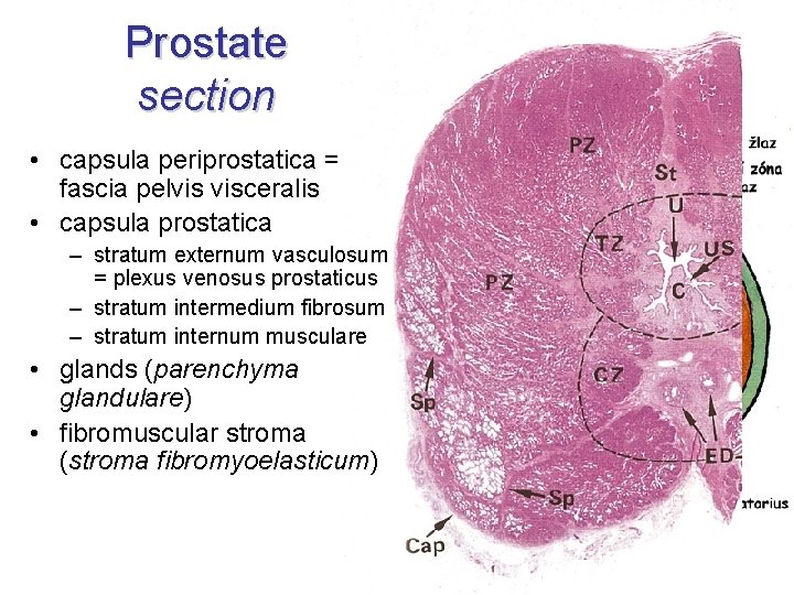 capsula prostatei cum se tratează prostatitacum sa adenomulprostata trata