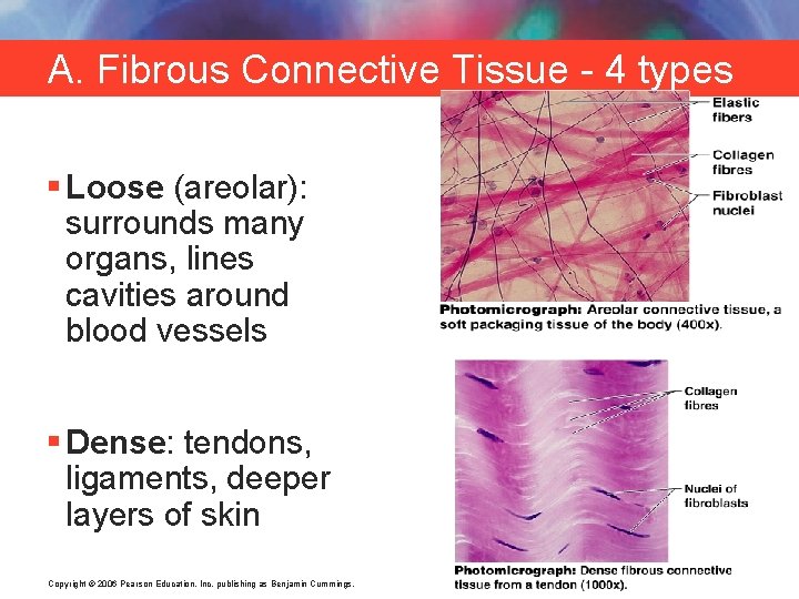 A. Fibrous Connective Tissue - 4 types § Loose (areolar): surrounds many organs, lines