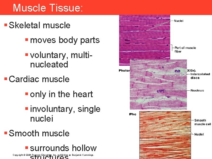 Muscle Tissue: § Skeletal muscle § moves body parts § voluntary, multinucleated § Cardiac