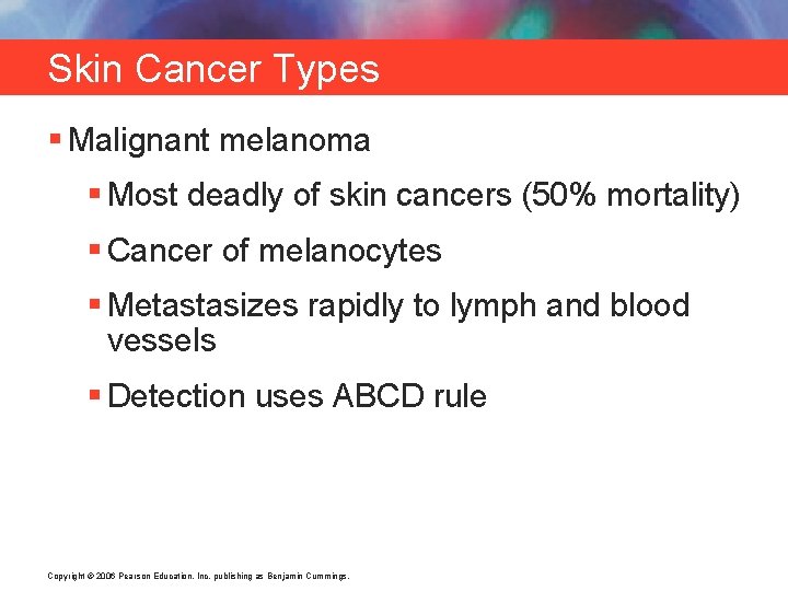 Skin Cancer Types § Malignant melanoma § Most deadly of skin cancers (50% mortality)