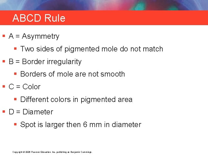 ABCD Rule § A = Asymmetry § Two sides of pigmented mole do not