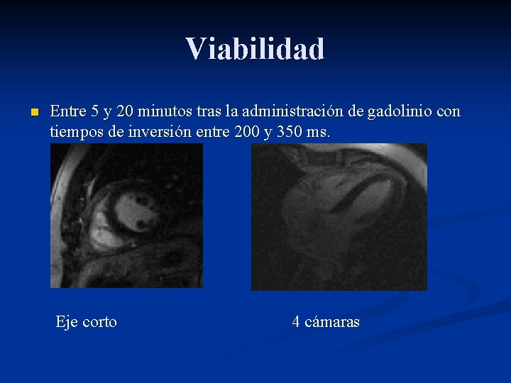 Viabilidad n Entre 5 y 20 minutos tras la administración de gadolinio con tiempos