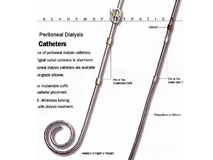 Peritoneal Dialysis 