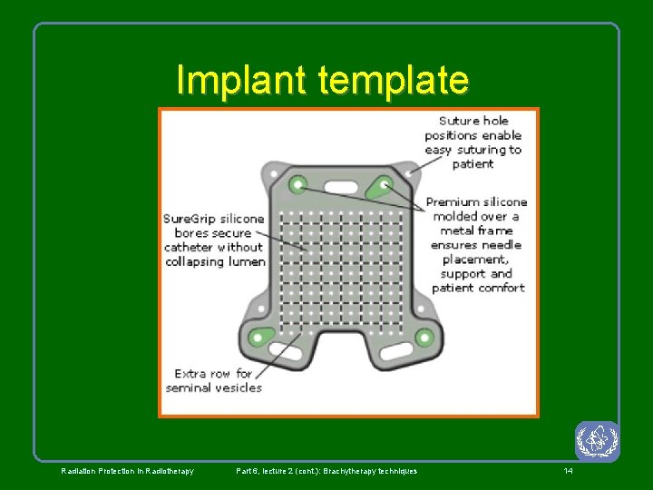 Implant template Radiation Protection in Radiotherapy Part 6, lecture 2 (cont. ): Brachytherapy techniques