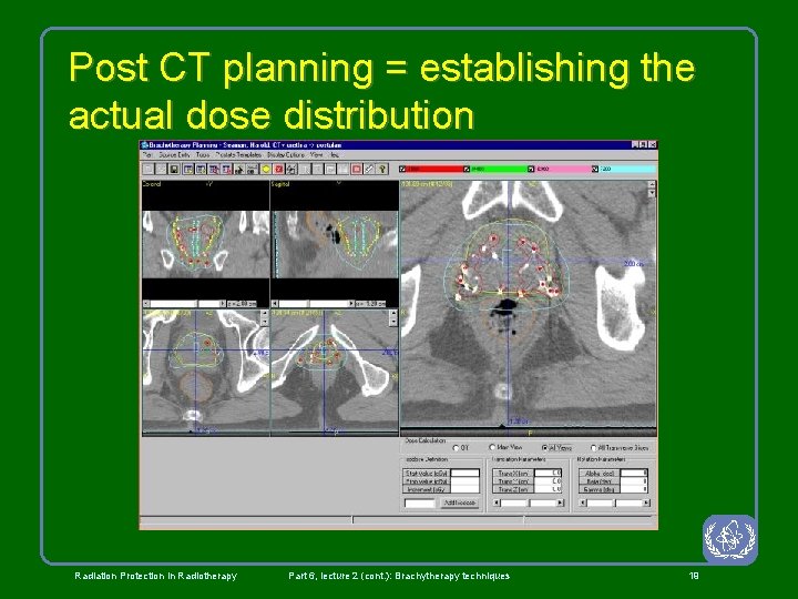 Post CT planning = establishing the actual dose distribution Radiation Protection in Radiotherapy Part