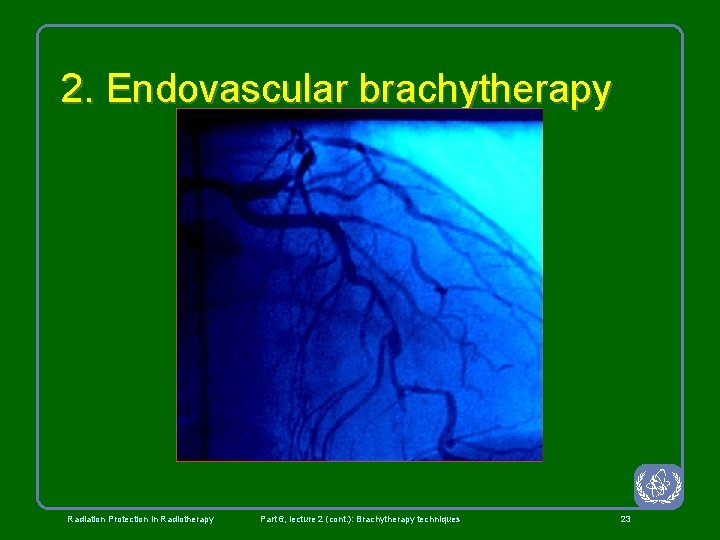 2. Endovascular brachytherapy Radiation Protection in Radiotherapy Part 6, lecture 2 (cont. ): Brachytherapy