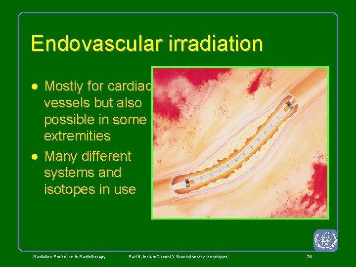 Endovascular irradiation l l Mostly for cardiac vessels but also possible in some extremities