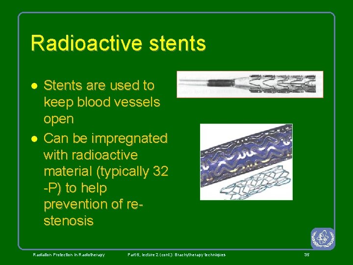 Radioactive stents l l Stents are used to keep blood vessels open Can be