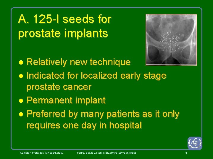 A. 125 -I seeds for prostate implants Relatively new technique l Indicated for localized