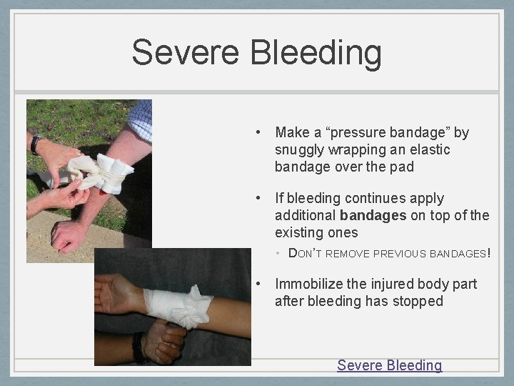 Severe Bleeding • Make a “pressure bandage” by snuggly wrapping an elastic bandage over