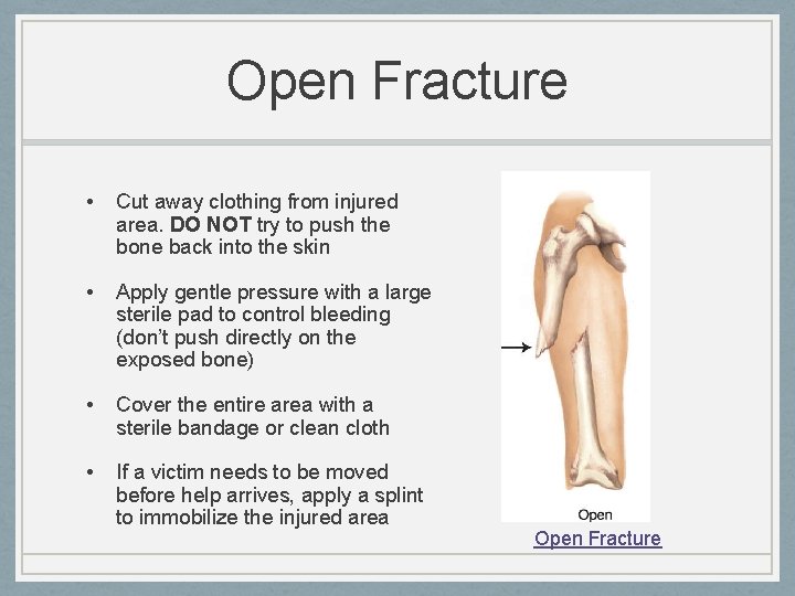 Open Fracture • Cut away clothing from injured area. DO NOT try to push