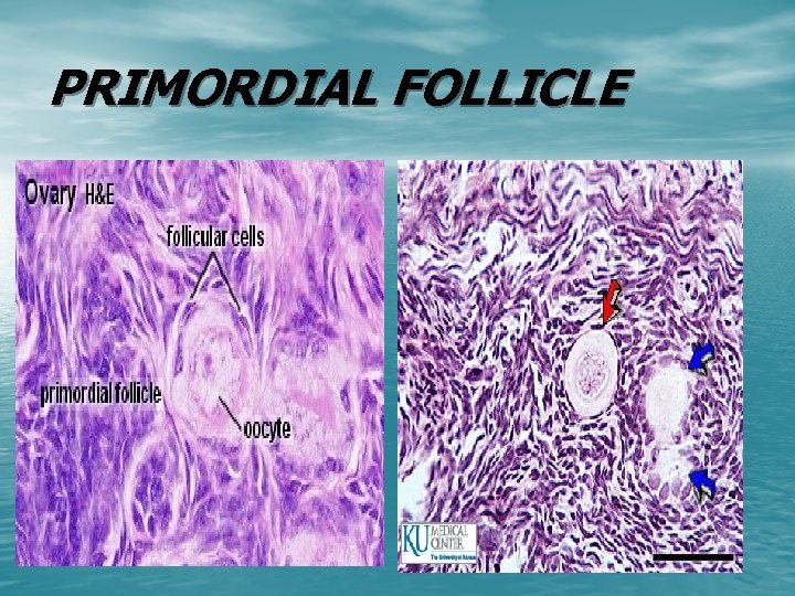 PRIMORDIAL FOLLICLE 