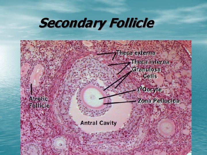 Secondary Follicle 