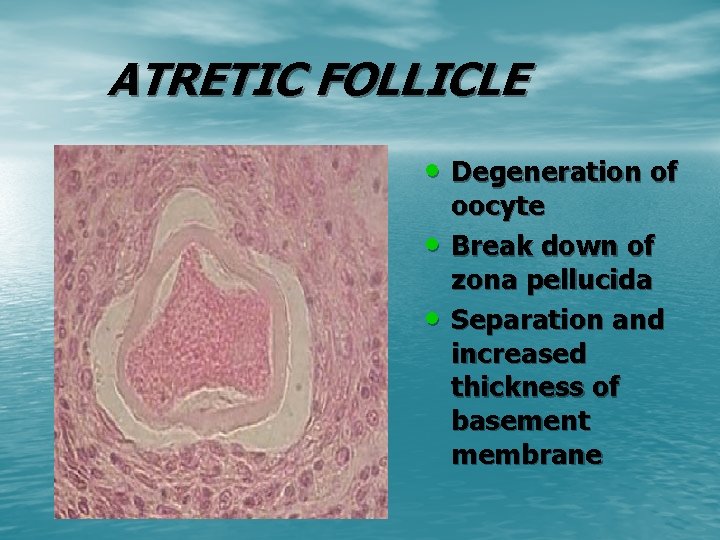 ATRETIC FOLLICLE • Degeneration of • • oocyte Break down of zona pellucida Separation