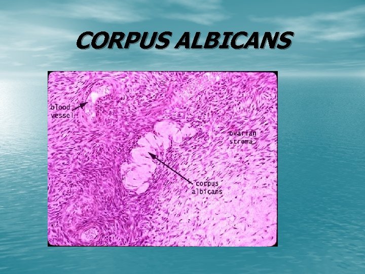 CORPUS ALBICANS 