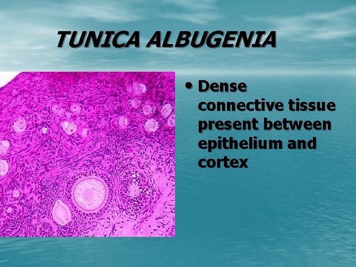 TUNICA ALBUGENIA • Dense connective tissue present between epithelium and cortex 