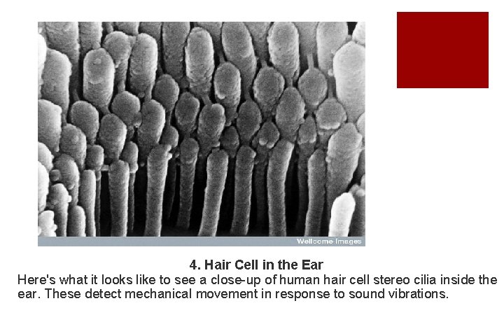 4. Hair Cell in the Ear Here's what it looks like to see a
