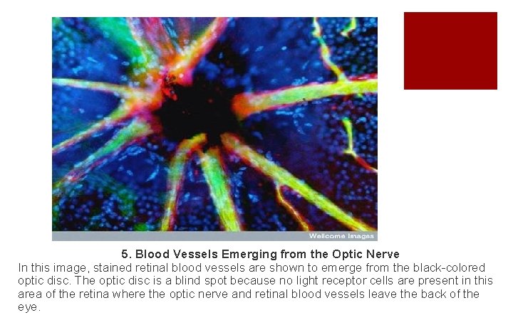 5. Blood Vessels Emerging from the Optic Nerve In this image, stained retinal blood