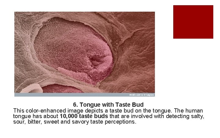 6. Tongue with Taste Bud This color-enhanced image depicts a taste bud on the