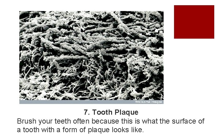 7. Tooth Plaque Brush your teeth often because this is what the surface of