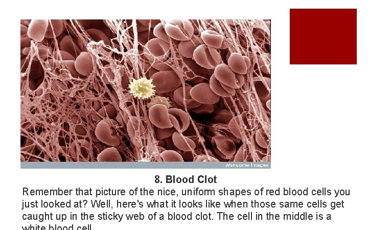 8. Blood Clot Remember that picture of the nice, uniform shapes of red blood