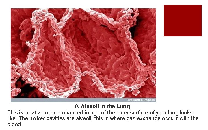 9. Alveoli in the Lung This is what a colour-enhanced image of the inner