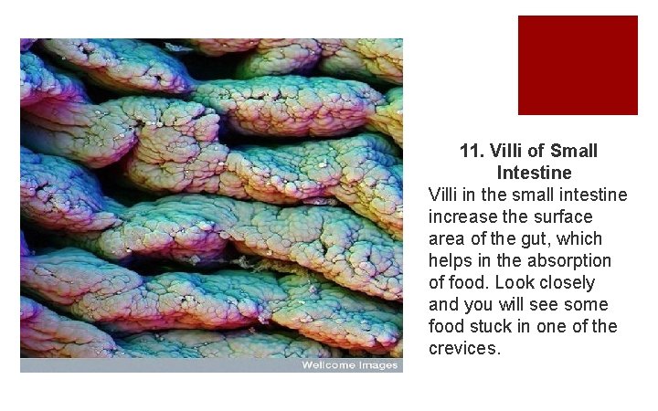 11. Villi of Small Intestine Villi in the small intestine increase the surface area
