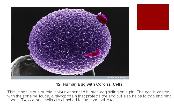 12. Human Egg with Coronal Cells This image is of a purple, colour-enhanced human