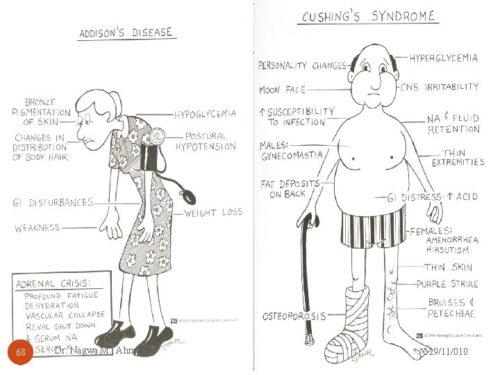 Cushing’s Syndrome 68 Dr: Nagwa M. , Ahmed 29/11/010 