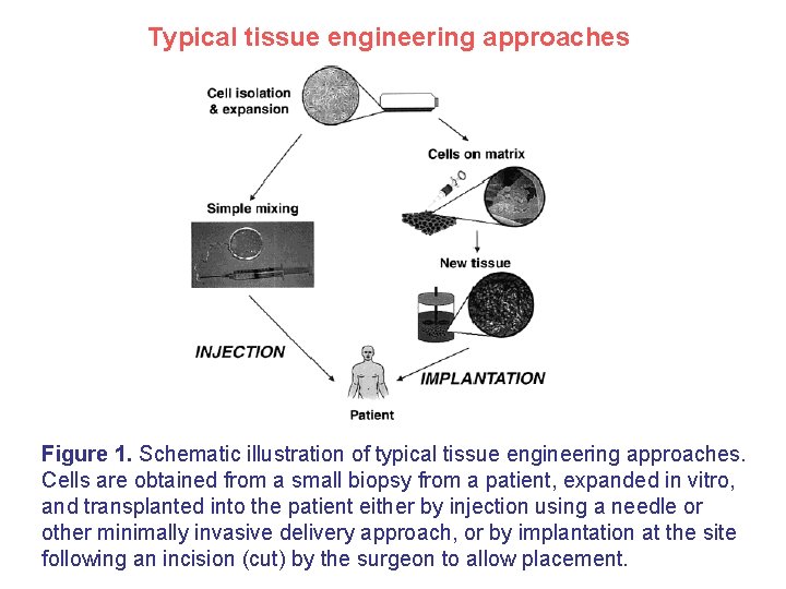 Typical tissue engineering approaches Figure 1. Schematic illustration of typical tissue engineering approaches. Cells