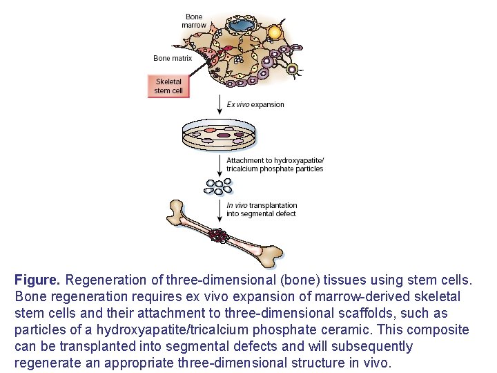 Figure. Regeneration of three-dimensional (bone) tissues using stem cells. Bone regeneration requires ex vivo