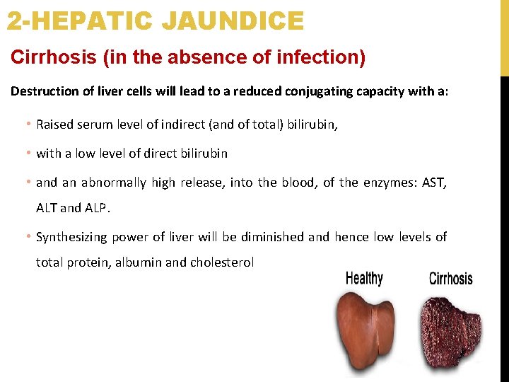 2 -HEPATIC JAUNDICE Cirrhosis (in the absence of infection) Destruction of liver cells will