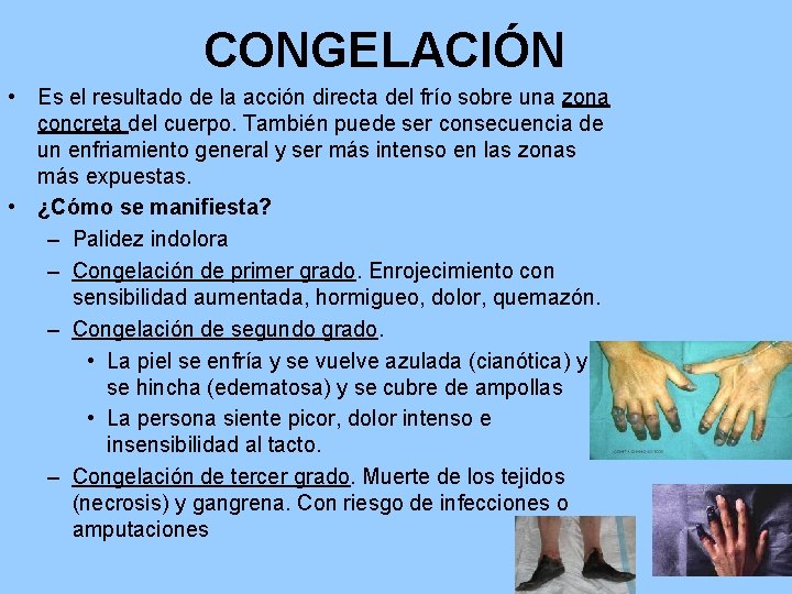 CONGELACIÓN • Es el resultado de la acción directa del frío sobre una zona