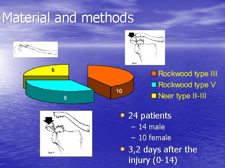 Material and methods 6 10 8 • 24 patients – 14 male – 10