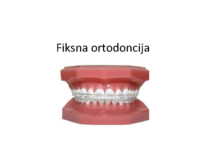 Fiksna ortodoncija 