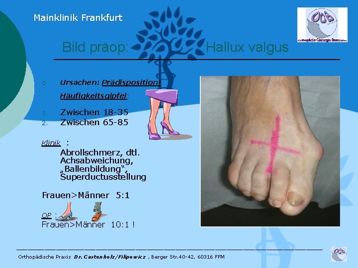 Mainklinik Frankfurt Bild präop: ¡ Hallux valgus Ursachen: Prädisposition! Häufigkeitsgipfel: 1. 2. Zwischen 18